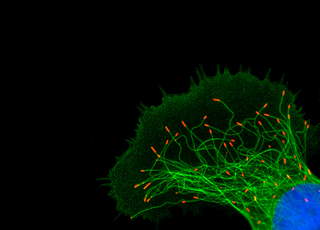 Illustration for article titled Parasites, deadly bugs and fungi are more beautiful than you could possibly imagine